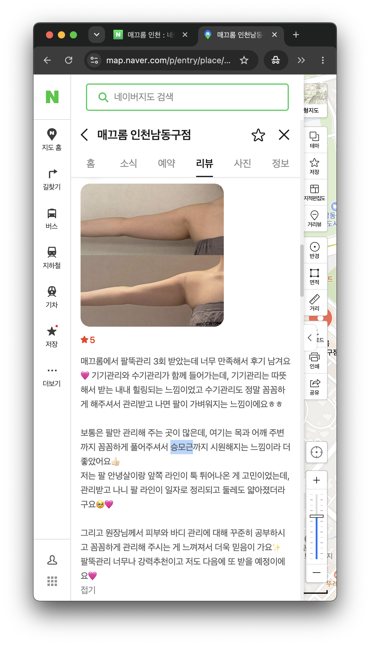 승모근 및 팔 라인 관리 전후 변화를 보여주는 여성 상반신