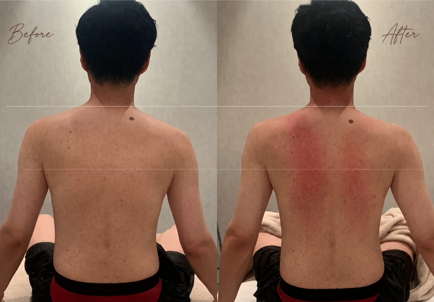 41세 개발자 고객을 등 뒤에서 본 관리 전후 비교. 왼쪽은 관리 전, 오른쪽은 관리 후