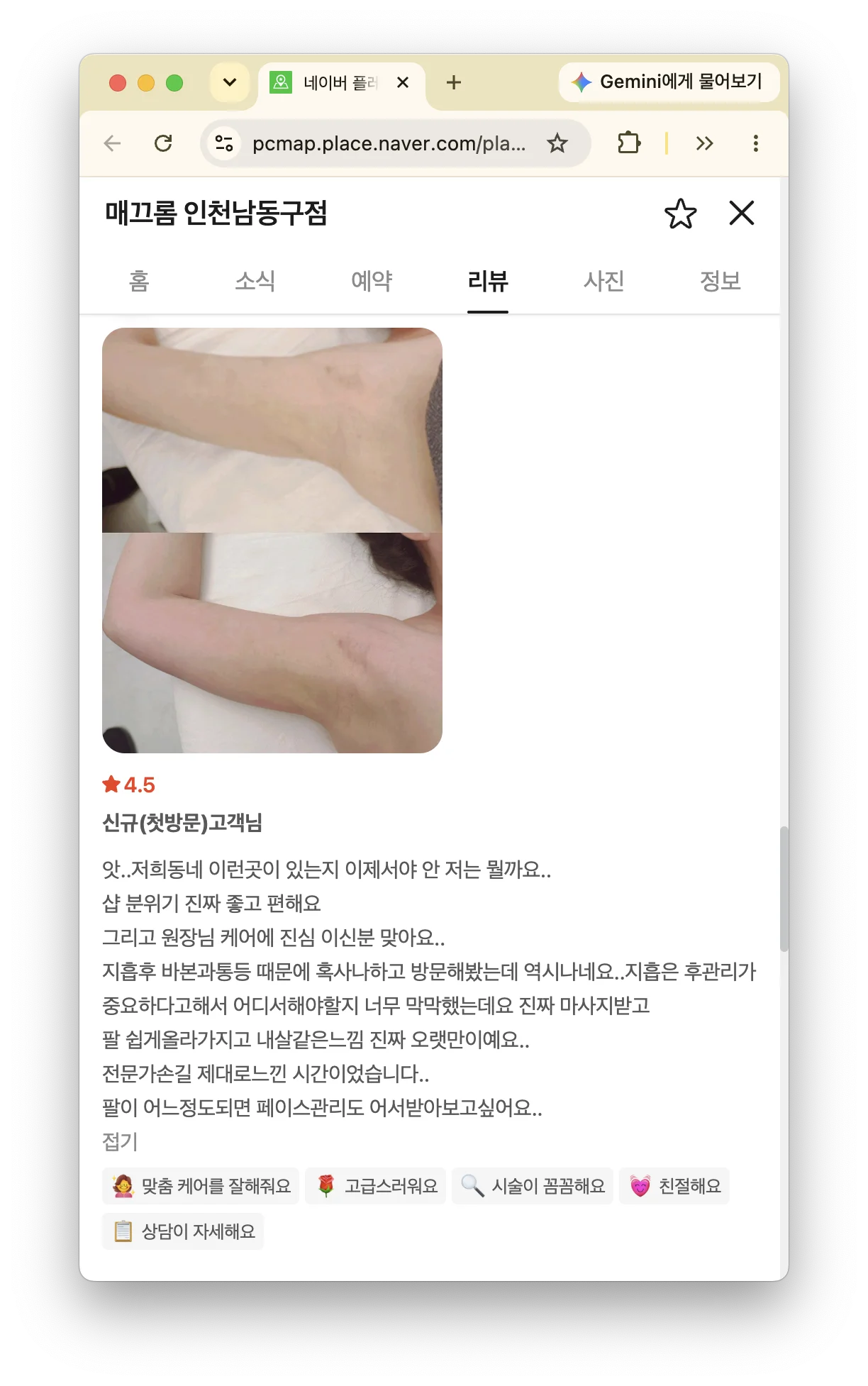 매끄롬 성수점에서 성형 후 림프관리를 받은 고객의 실제 후기입니다.