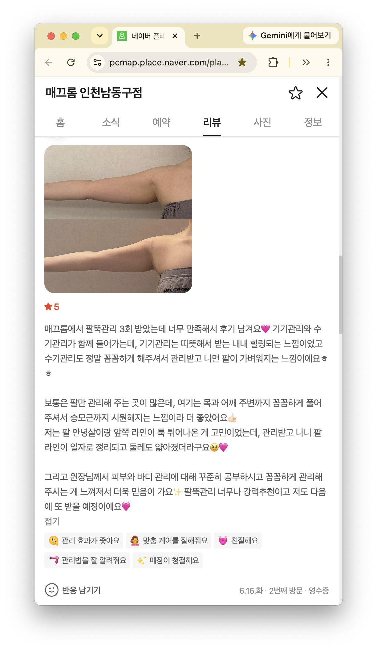 팔뚝관리 3회 경험과 비교 사진을 함께 남긴 매끄롬 인천남동구점 고객 후기 화면