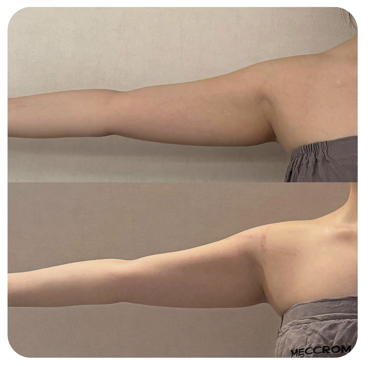 Two photos showing the customer's outstretched arm from the side