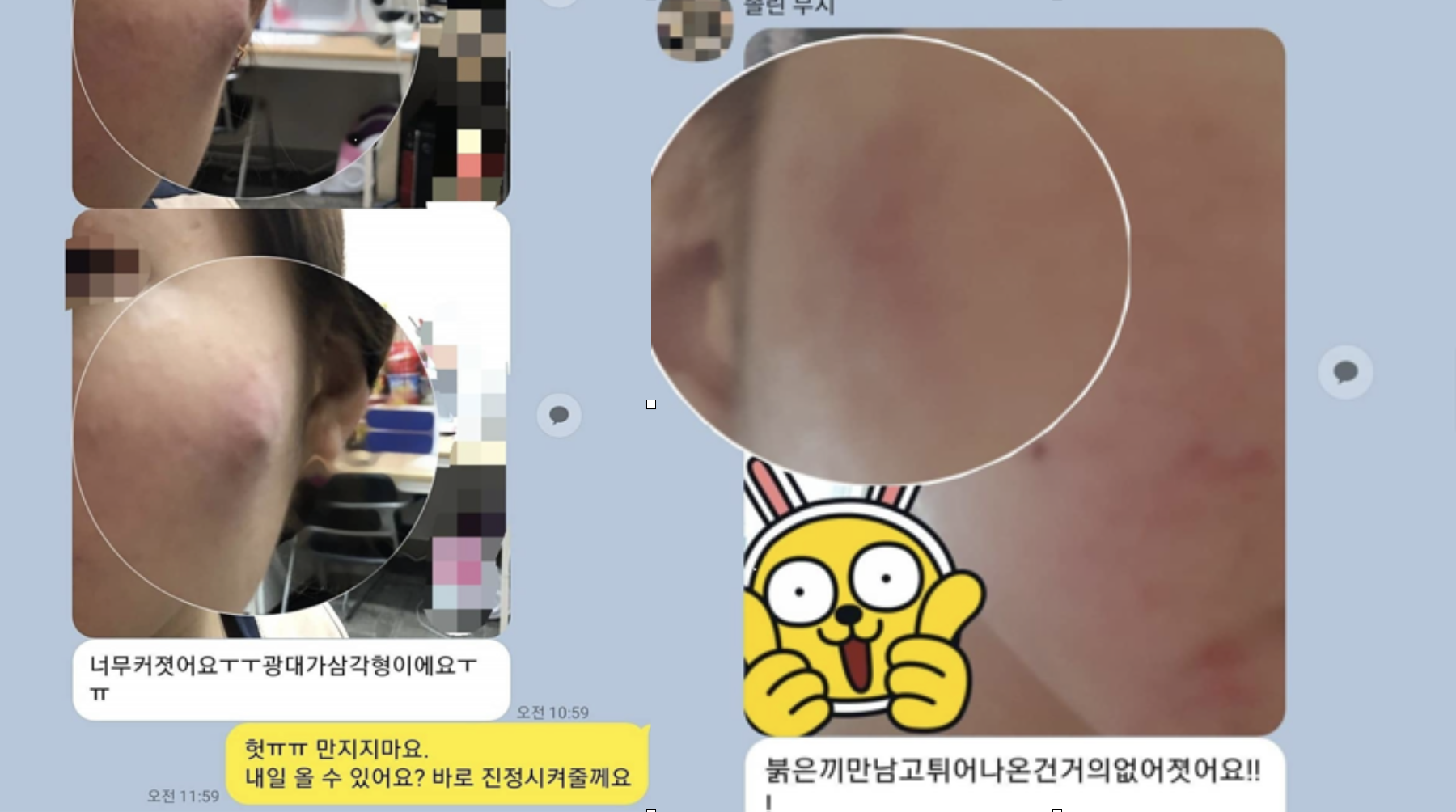 소개팅을 앞두고 광대 부근 트러블을 문의한 고객님과 진정 관리 뒤 받은 카카오톡 메시지
