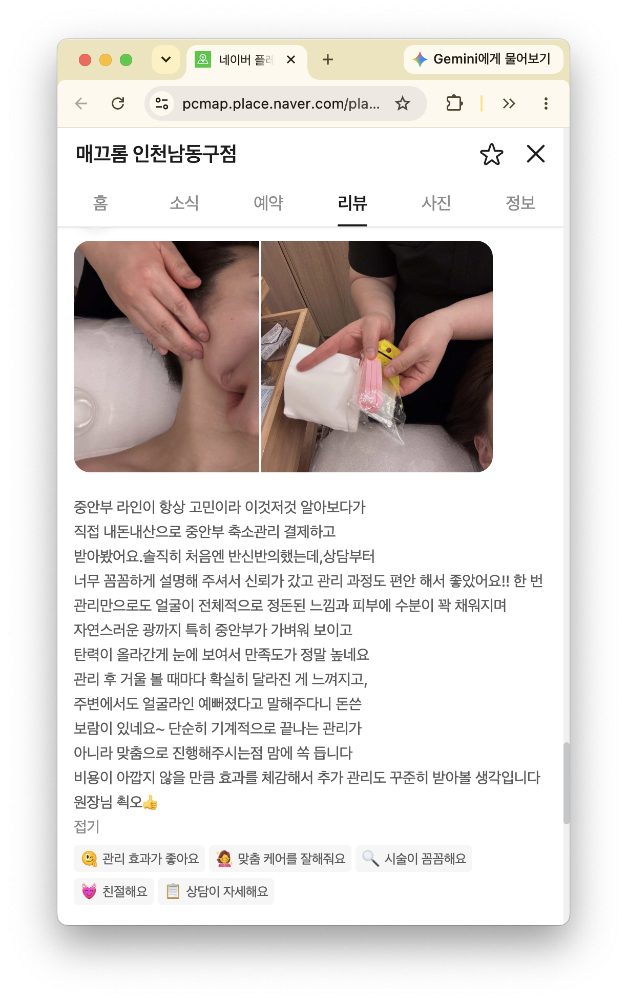 중안부와 얼굴라인에 관한 매끄롬 인천남동구점 윤곽관리 후기 화면