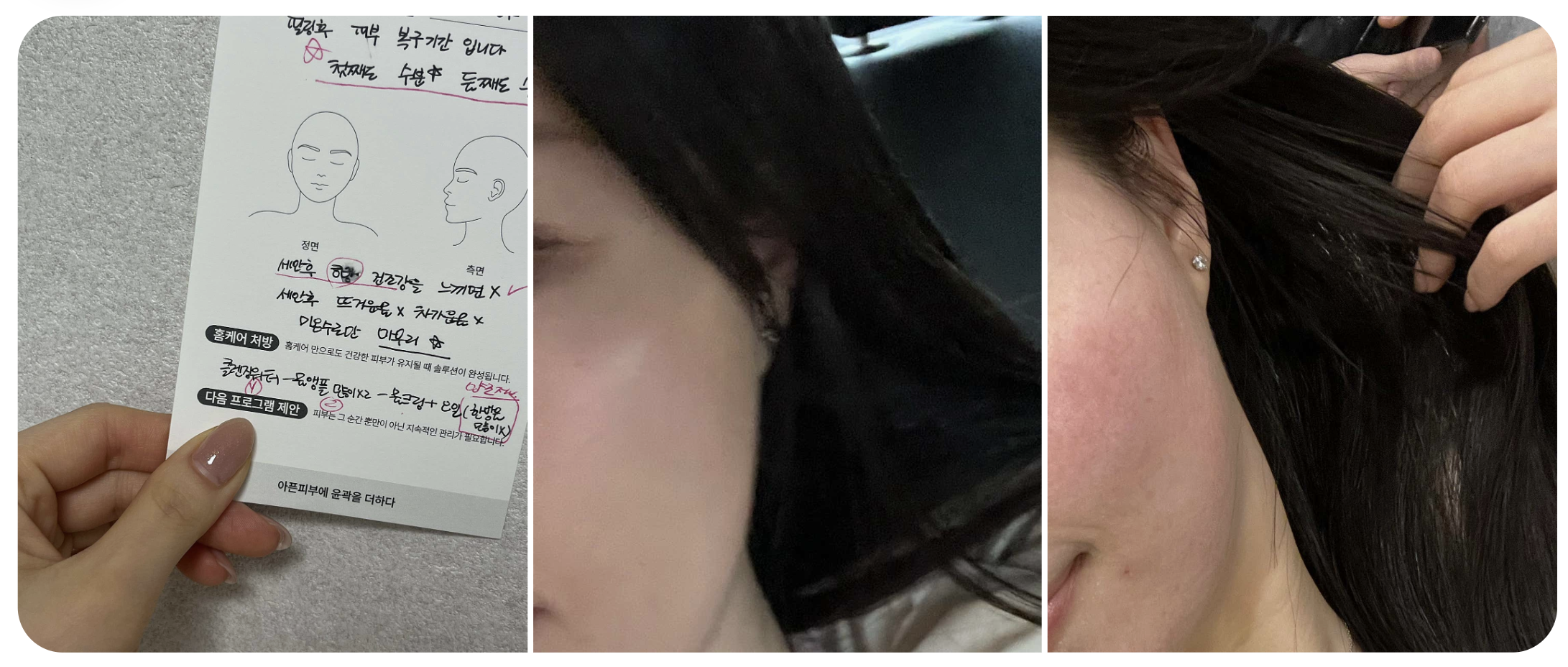 Skin consultation notes and cheek photos provided by the customer