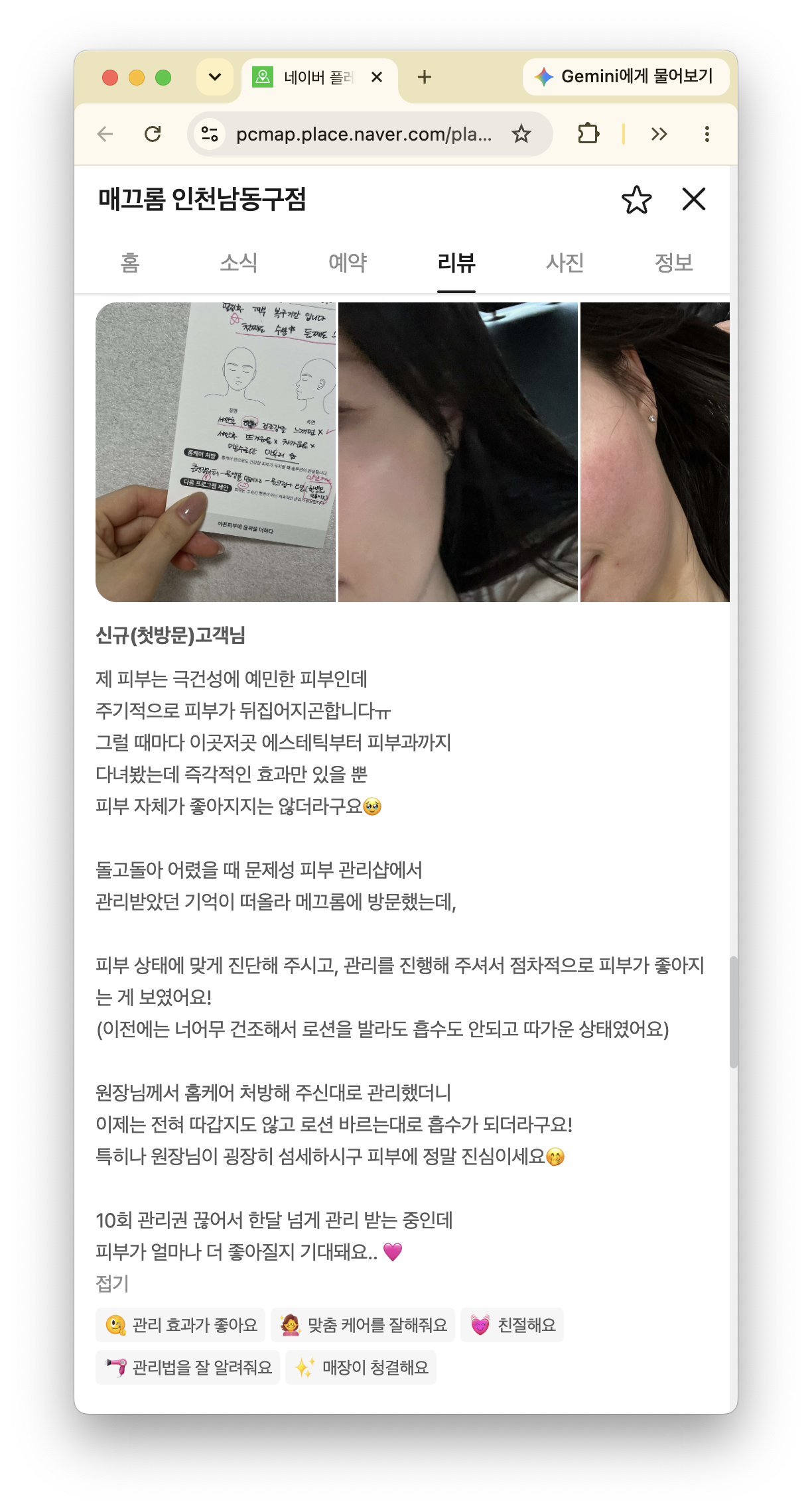 극건성과 피부 당김에 관한 매끄롬 인천남동구점 민감성 피부관리 후기 화면