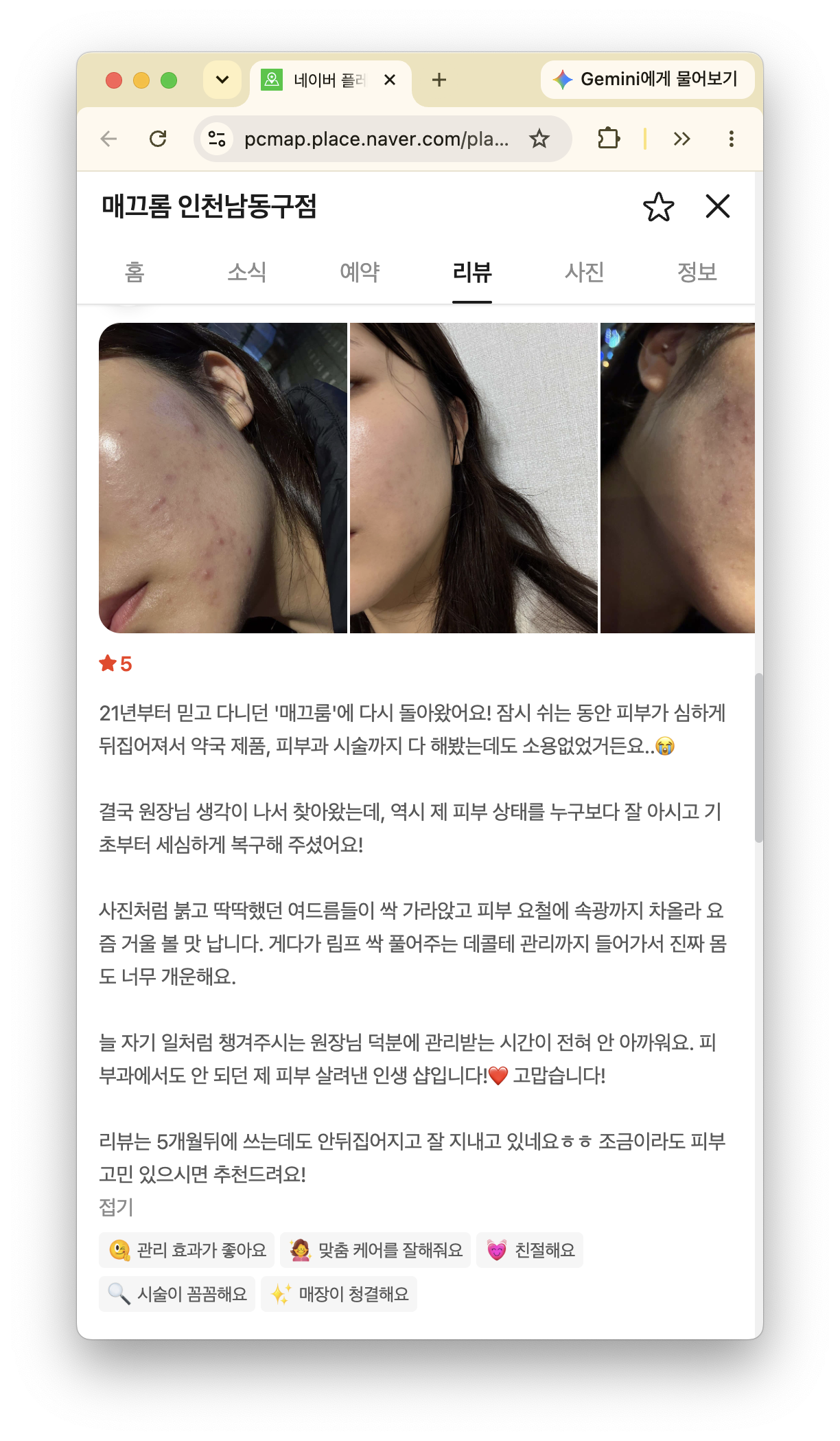 피부 고민과 관리 경험을 남긴 매끄롬 인천남동구점 고객 후기 화면
