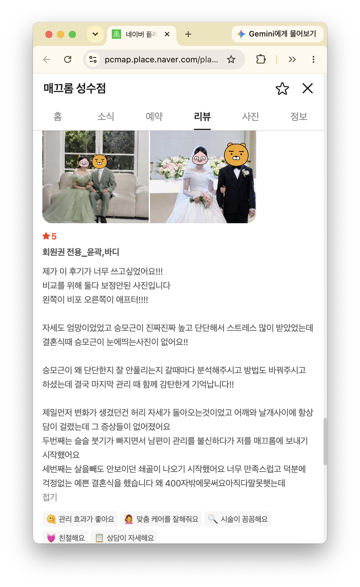 결혼식 전 승모근 관리를 받은 고객 후기