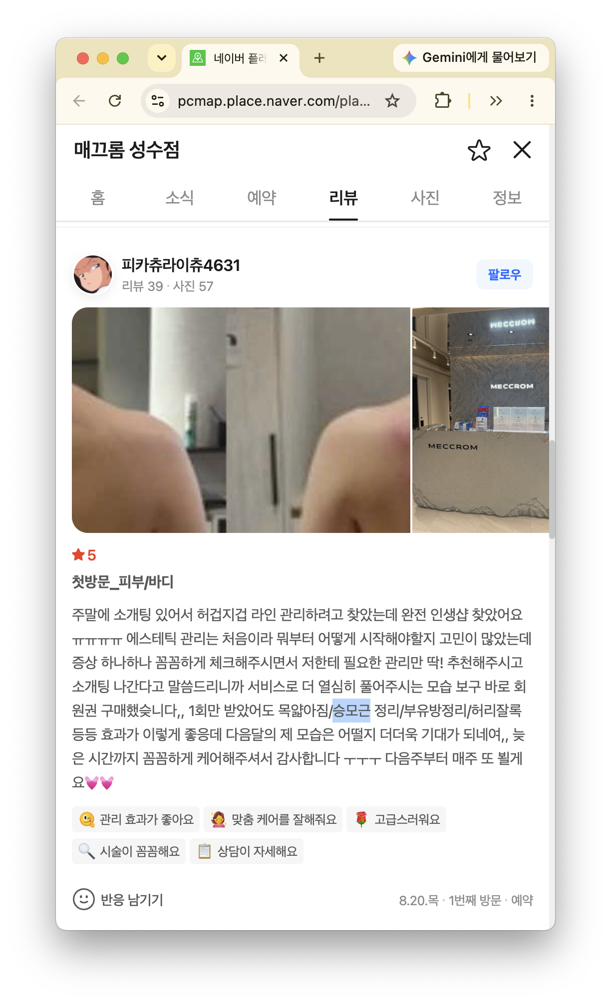 소개팅 전 허리와 승모근 관리를 받은 고객 후기