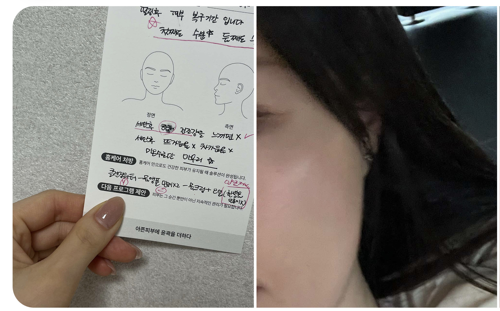 피부 상태와 생활 습관을 살피는 맞춤 상담 안내