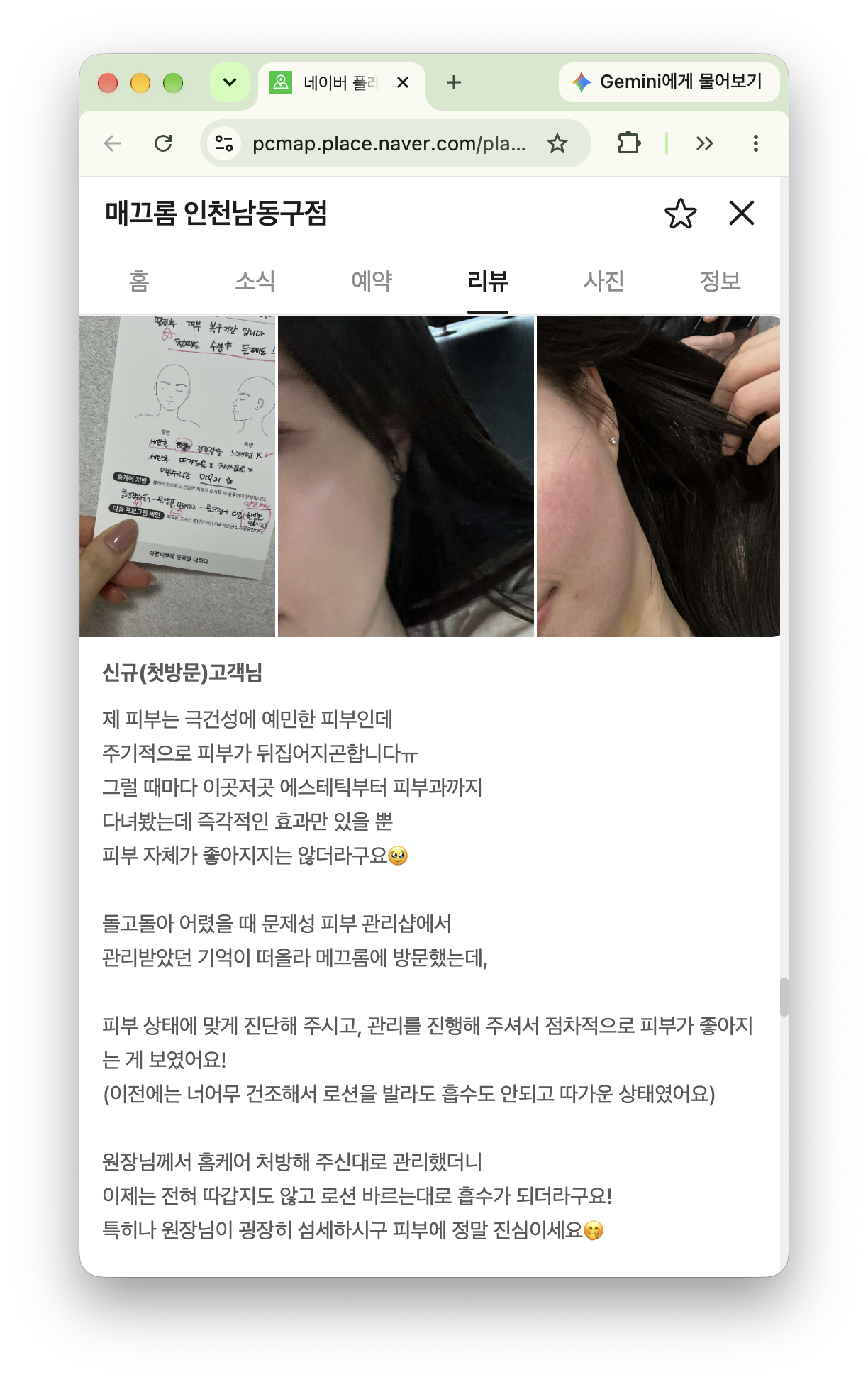 매끄롬 인천남동구점 피부 관리에 관한 네이버 방문자 후기